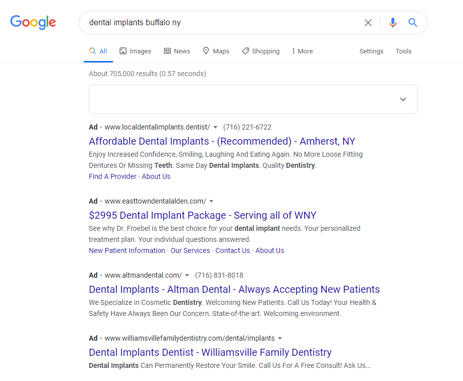 Dental Implant Marketing Using Google Ads
