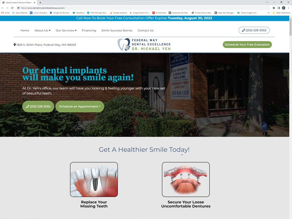 dental implant platform website